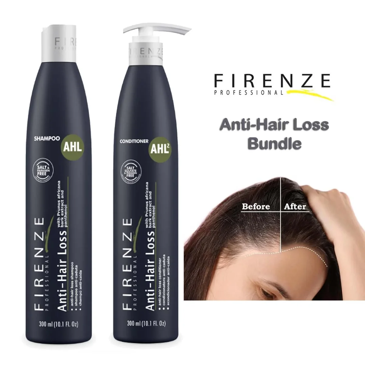 FIRENZE Anti Hair Loss Conditioner – 300 ml (10.1 Fl. Oz.) Acondicionador fortalecedor para cabello débil, frágil y con tendencia al quiebre - Imagen 4